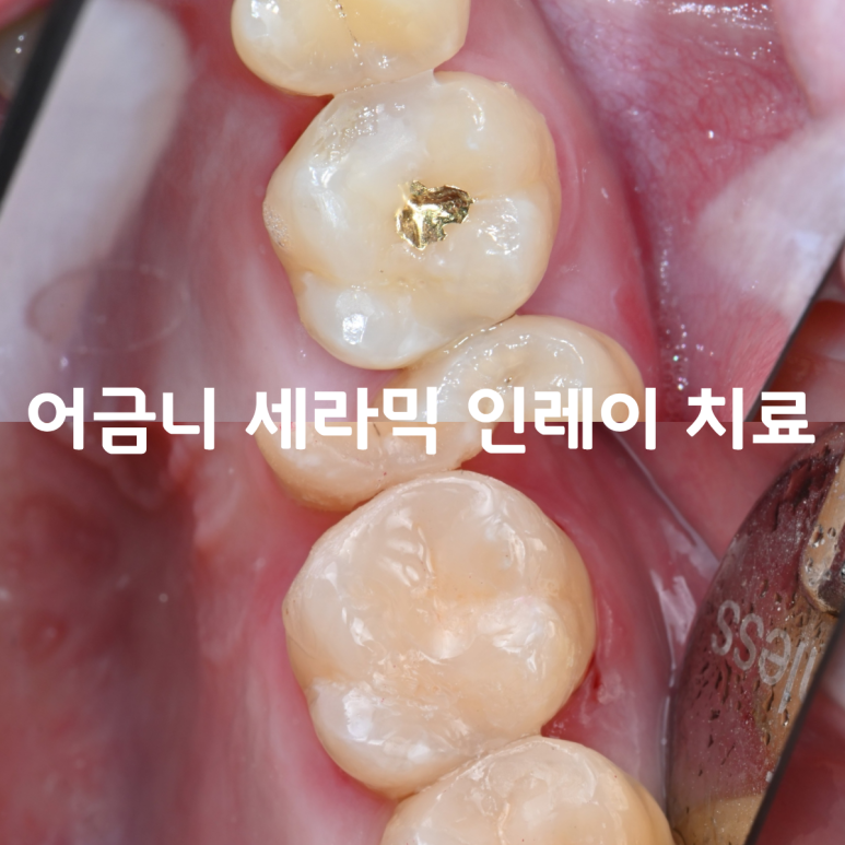 [치료사례] 